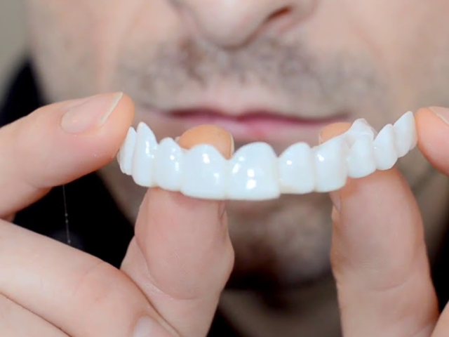 Snap-On Smile