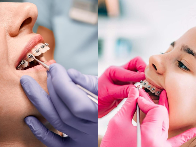 Orthodontics
