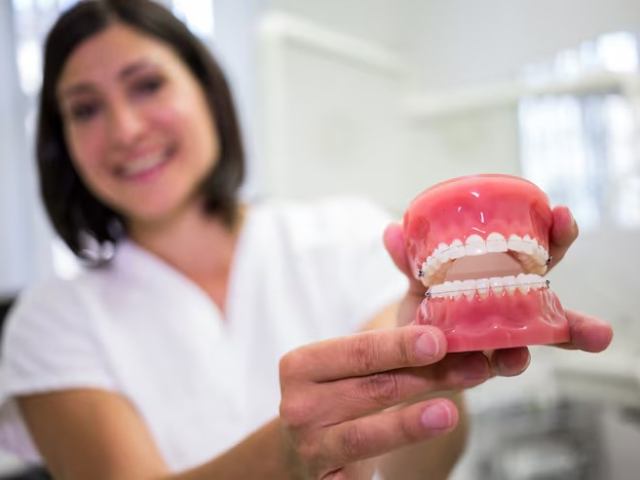Acrylic Denture Solutions in Abu Dhabi 