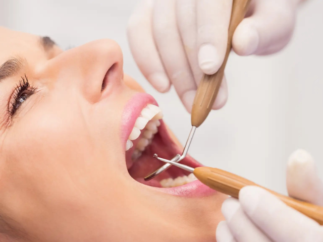 Teeth Cleaning in Hamdan Street Abu Dhabi